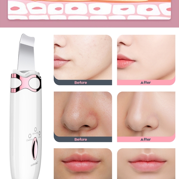 NEW! Waterproof Ultrasonic Exfoliating Wand - Picture 4 of 11